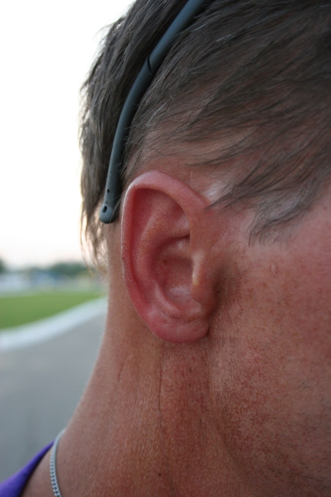 Layton Fossum's reconstructed ear