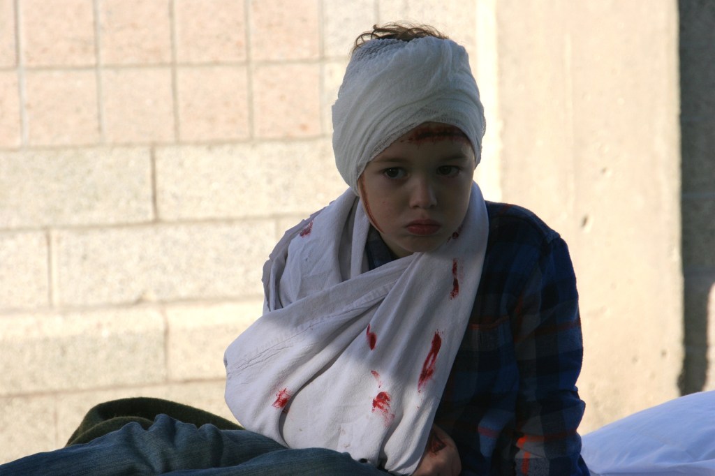 A boy feigns mock injuries for the living history event in Faribault.