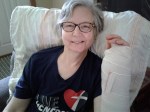 audrey post surgery